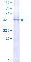 12.5% SDS-PAGE Stained with Coomassie Blue.